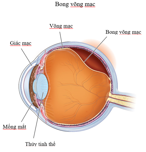 phẫu thuật điều trị các bệnh lý dịch kính võng mac