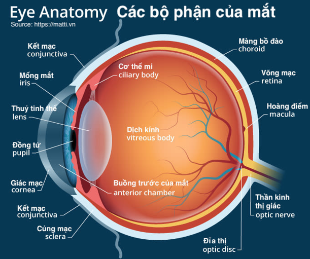 Phẫu thuật cắt dịch kính