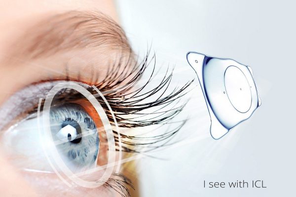 Phẫu thuật Phakic ICL tại Bệnh viện Mắt Hồng Sơn-Giải pháp hiệu quả cho người cận thị nặng