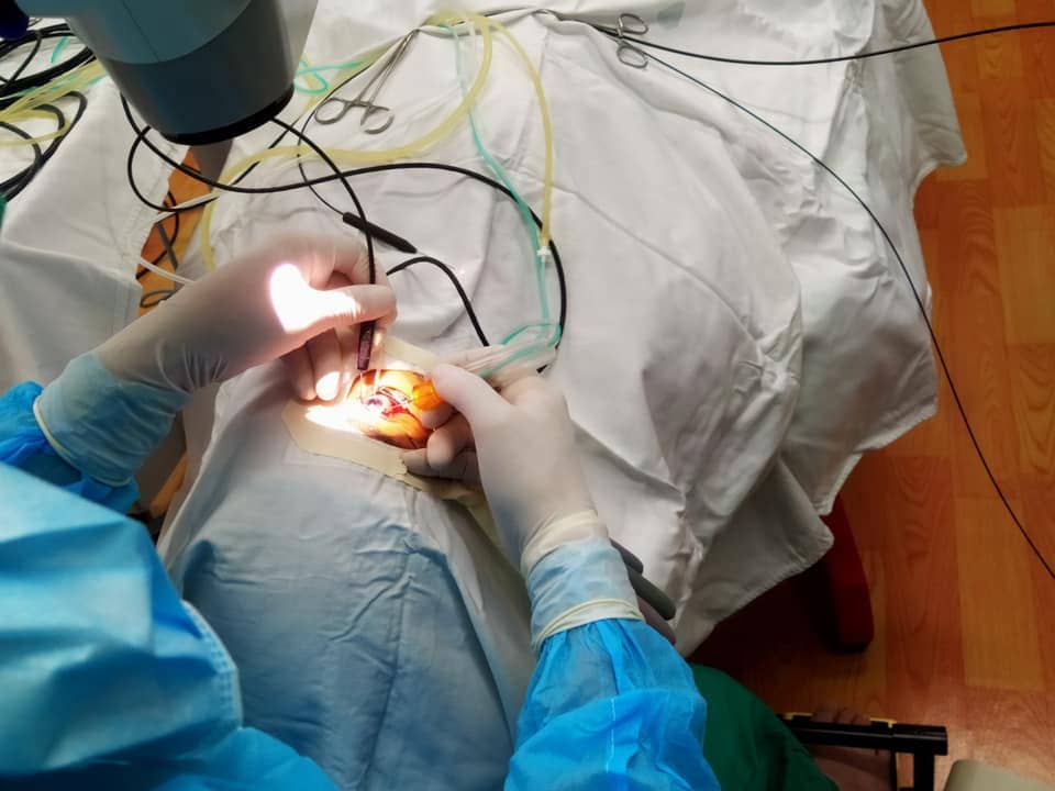 Phó Giáo Sư Cung Hồng Sơn và Bác sĩ Lê Quang Trung đang thực hiện ca mổ treo thuỷ tinh thể không khâu bằng phương pháp Yamane