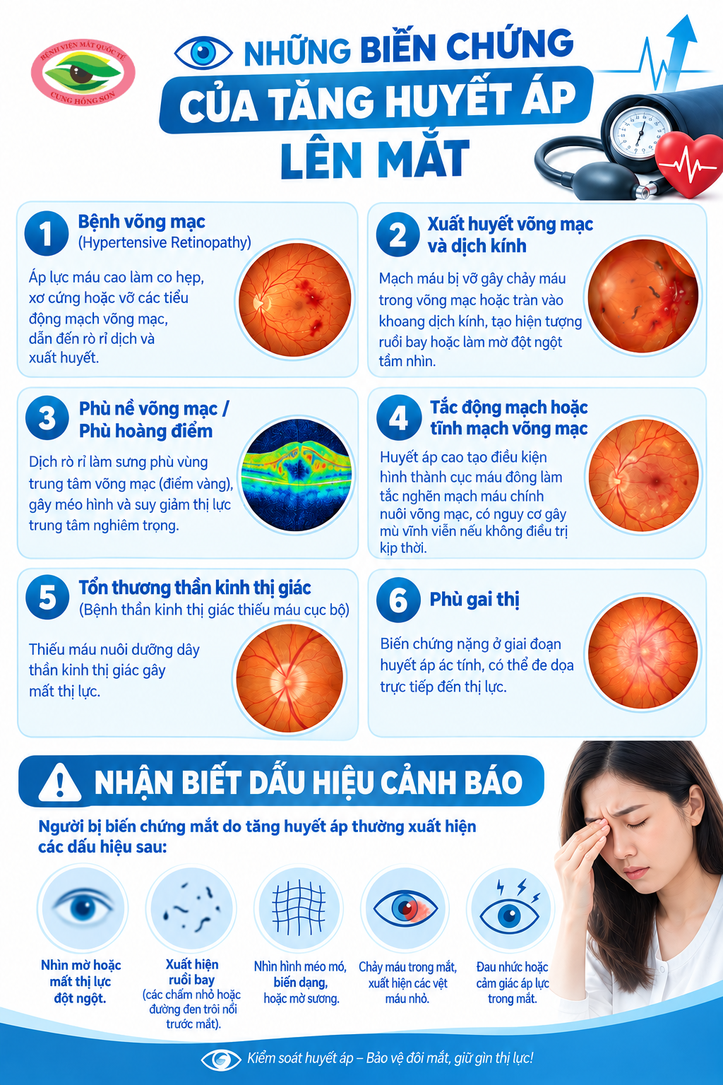 TĂNG HUYẾT ÁP – ĐỪNG CHỦ QUAN VỚI NHỮNG BIẾN CHỨNG Ở MẮT
