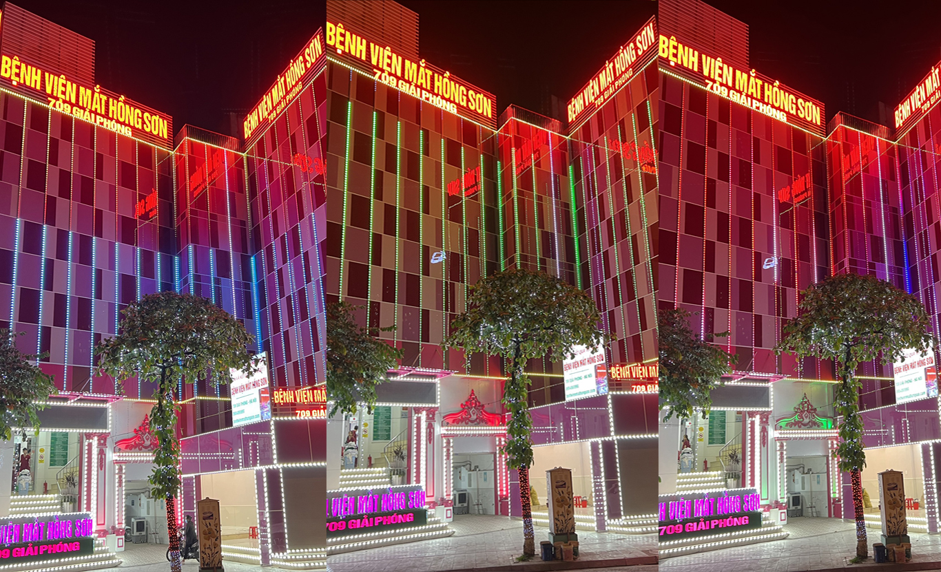 BV Mắt Hồng Sơn